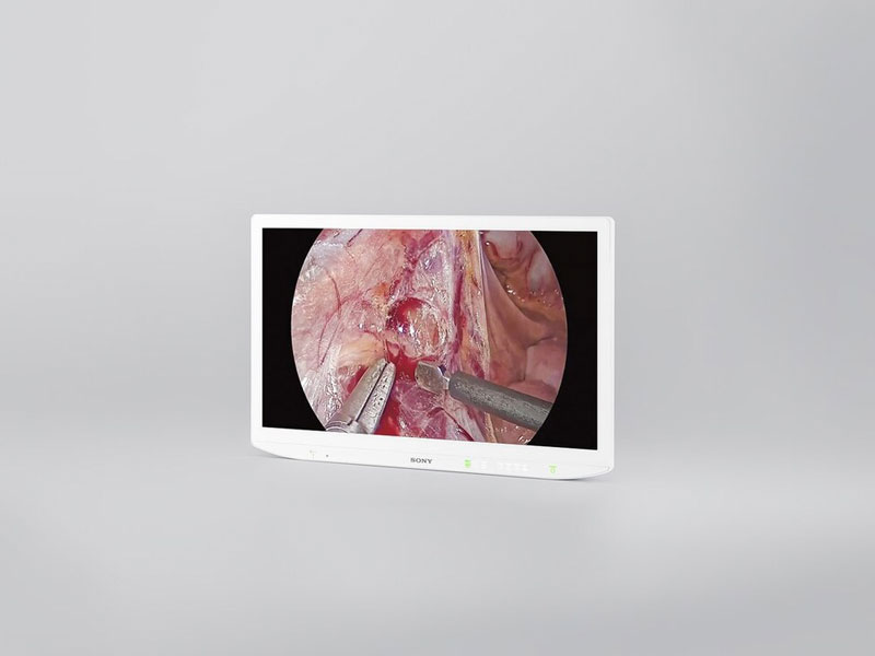 Building the Future of Surgical Solutions on a Simpler Yet Intuitive Foundation